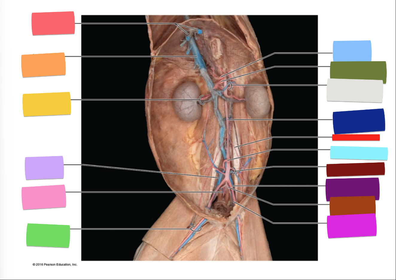 <p>dark burgundy </p>