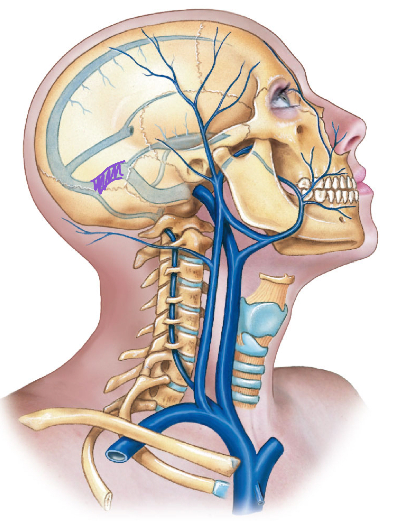 <p>diagram</p>
