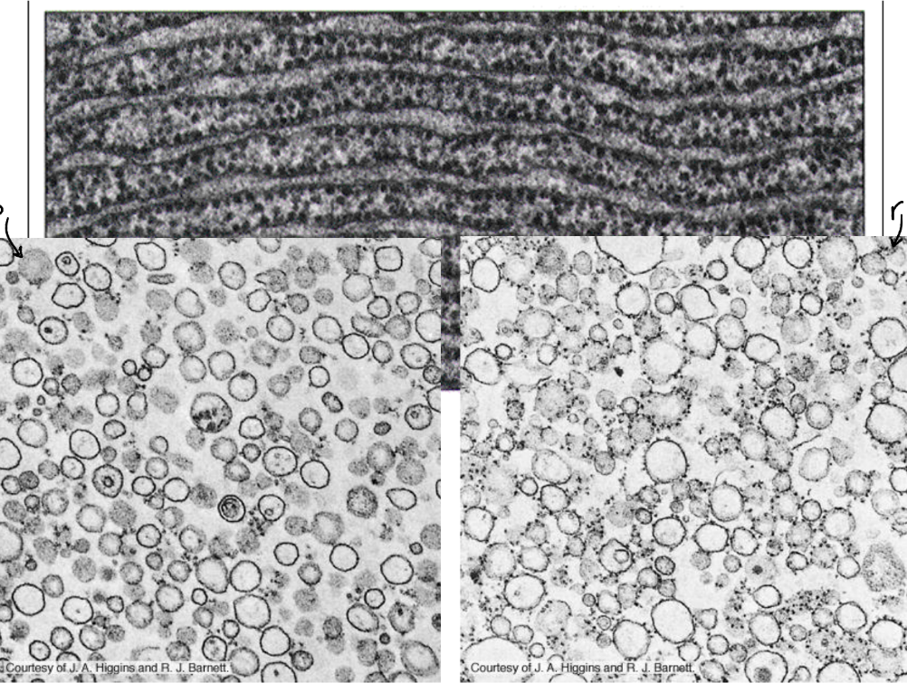 <p>Fragments of rough or smooth ER that seal themselves into tiny, artificial vesicles when cells are mechanically broken in a lab. </p>