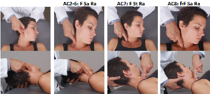 <ul><li><p>transverse process</p></li><li><p>F Sa Ra</p></li><li><p>neck pain, headache</p></li></ul><p></p>
