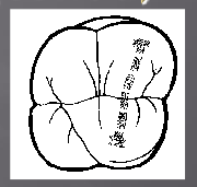 <p>Formed by two triangular ridges joining and crossing the surface of a posterior tooth diagonally rather than straight across buccopalatally</p>