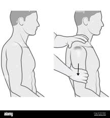 <p>Distal traction on relaxed arm; indicates inferior shoulder instability or GH laxity.</p>