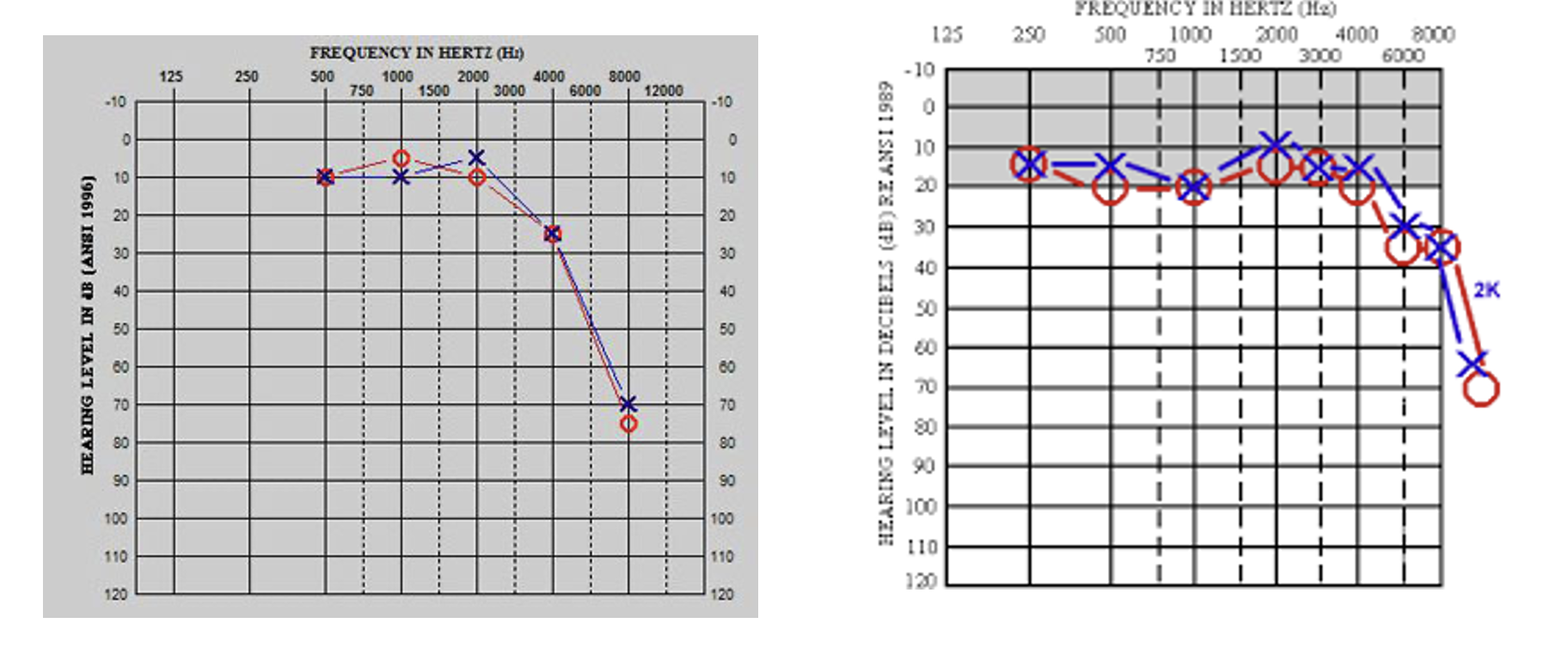 <p><span>Tinnitus (high-pitched)</span></p><p style="text-align: left;"><span>Usually patient is very sick from other medical conditions that warrant medications</span></p>