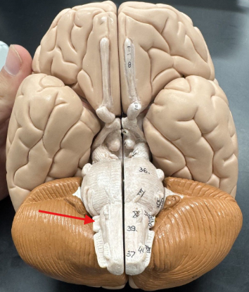 <p>glossopharyngeal </p>