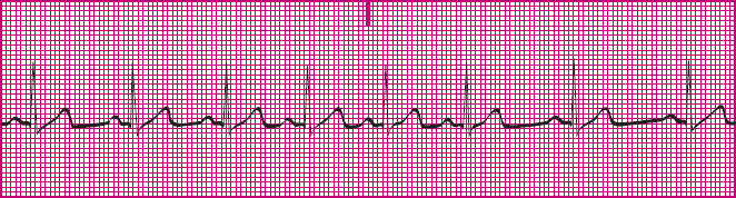 <p>What rhythm is this?</p>