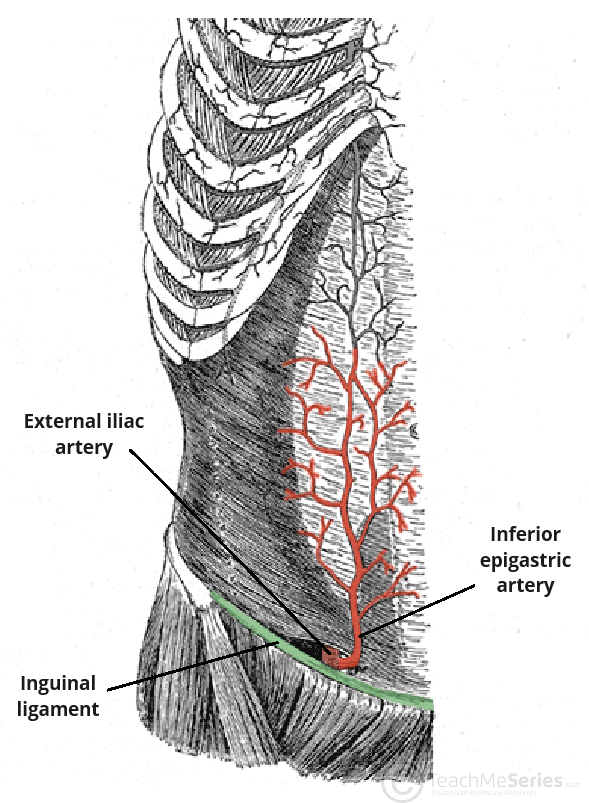 <p>Site of direct inguinal hernias.</p><p>Lateral: inferior epigastric artery</p><p>Inferior: Inguinal ligament</p><p>Medial: rectus abdominis muscle</p>