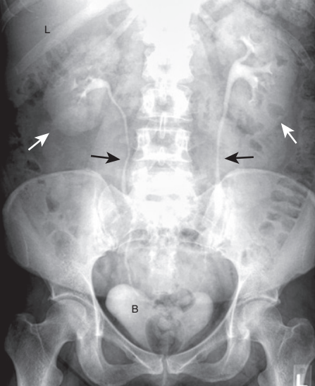 <p>White arrows are the?</p>