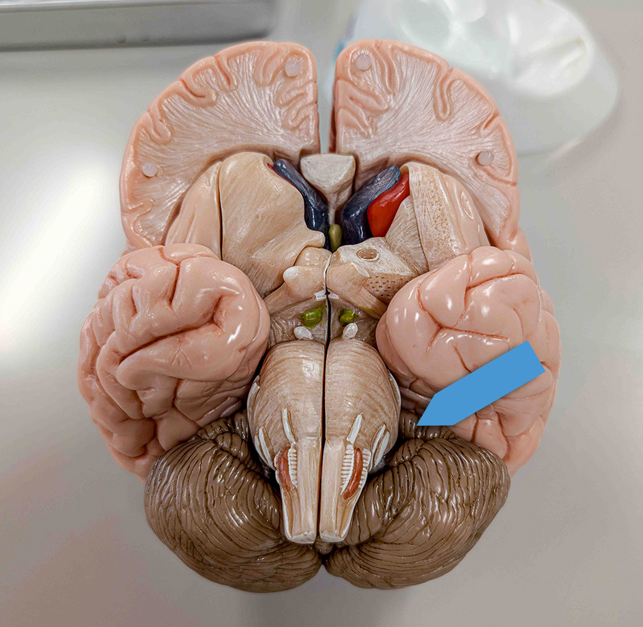 <p>Identify the region at the pointer.</p>