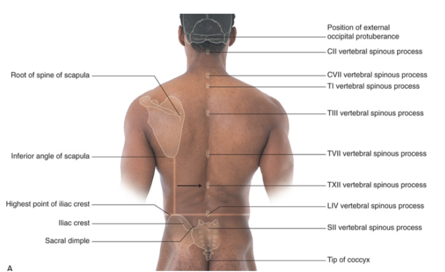 <p>highest point of iliac crest</p>