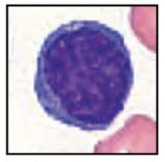 <p>Lymphocytes increase in what conditions?</p>