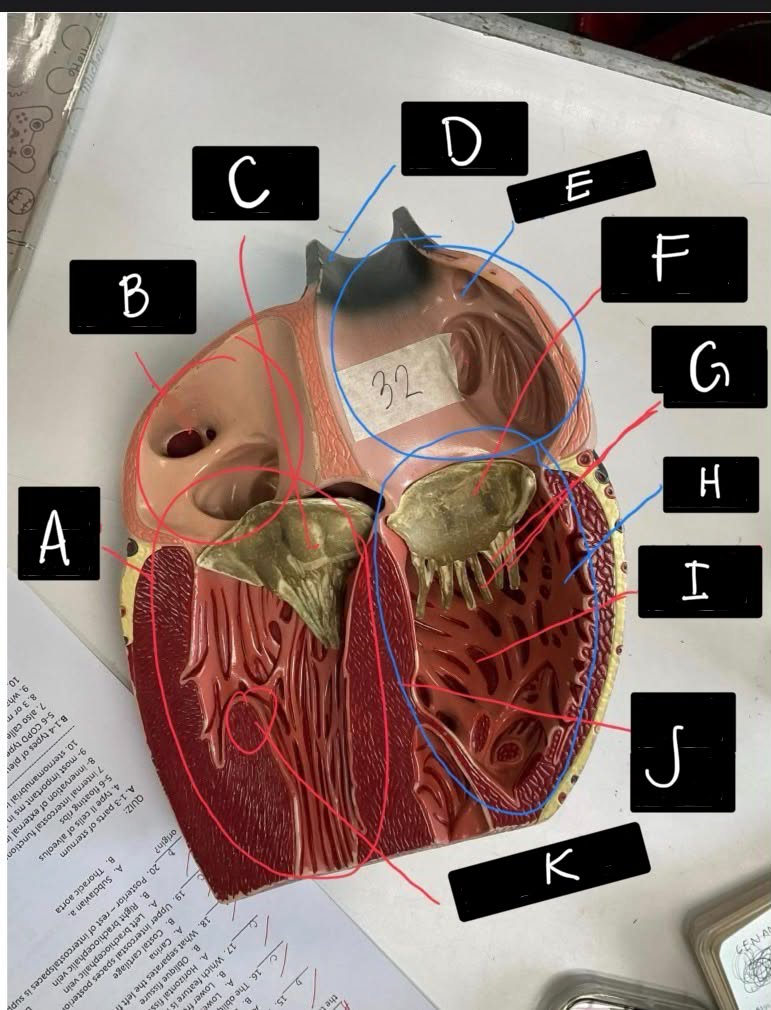 <p>Identify J</p>