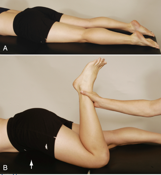 <p><strong>Purpose:</strong> Assess rectus femoris adaptive shortening<br></p><p><strong>How to Perform:</strong> Pt prone. Passively flex knee by moving heel toward ipsilateral buttock<br></p><p><strong>Positive Test: </strong>Pelvis lifts into anterior tilt or hip flexion before full knee range<br></p><p><strong>Interpretation: </strong>Rectus femoris tightness/shortening</p>