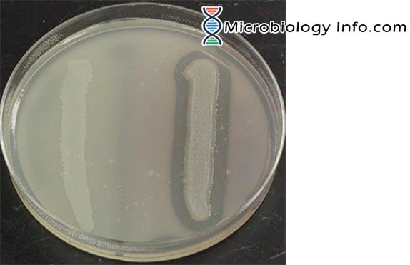 <p>Right side (Clearing in agar around growth)</p>