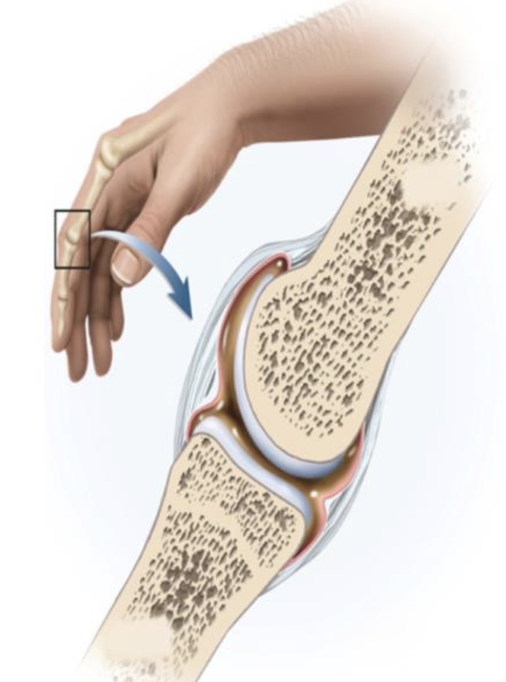 <p>Name the specific structure illustrated by the bright pink line.</p>
