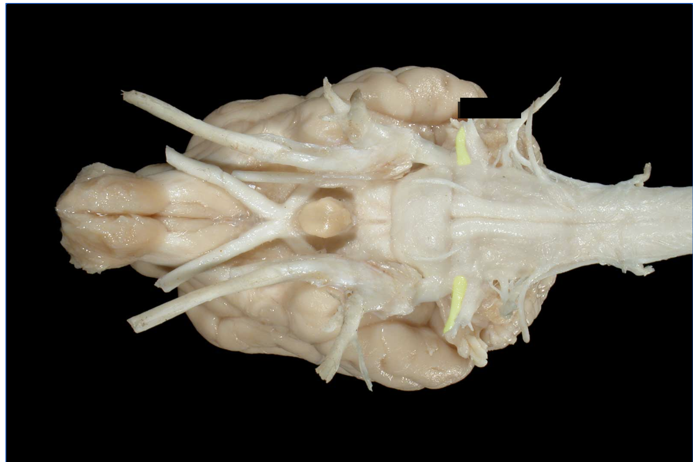 <p>what nerve is this</p>