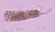 <p>Granular Cast </p>