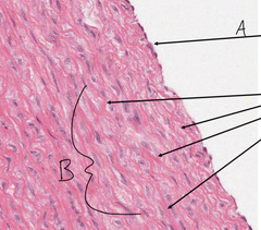 <p>What is indicated by arrow 'A' in this slide of a porcine aorta?</p>