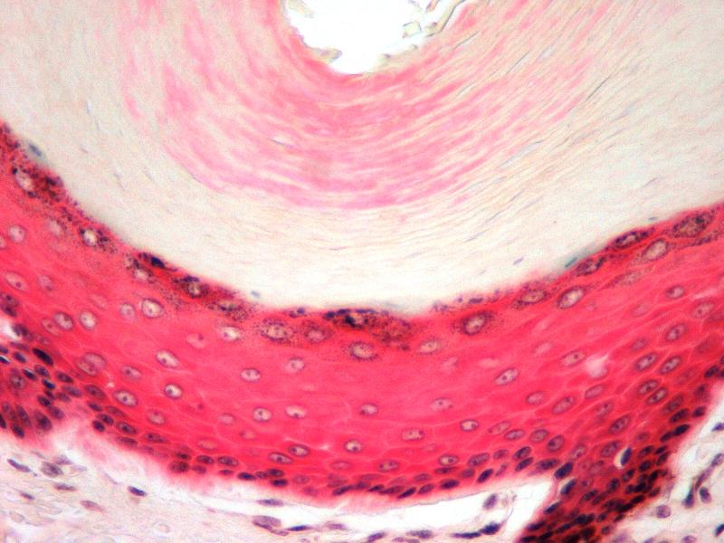 <p>epithelium, a tough layer of keratin (a protein resistant to friction and repels bacteria) is deposited in the surface cells. This is located on skin, hair and nails. This tissue will form a <strong>cutaneous membrane.</strong></p>