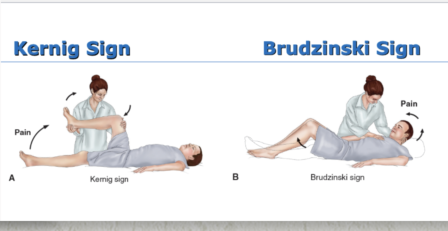 <ul><li><p><mark data-color="purple" style="background-color: purple; color: inherit;">Inflammation of the meninges, which cover and protect the brain and spinal cord</mark></p></li><li><p>Two main types classified as:</p><ul><li><p><mark data-color="purple" style="background-color: purple; color: inherit;">Septic caused by bacteria </mark>(Streptococcus pneumoniae, Neisseria meningitidis)</p><ul><li><p>N. meningitidis is transmitted by secretions or aerosol contamination, and infection is most likely in dense community groups, such as college campuses and military bases</p></li></ul></li><li><p><mark data-color="purple" style="background-color: purple; color: inherit;">Aseptic caused by viral</mark> infection secondary to cancer or a weak immune system</p></li></ul></li><li><p>Pathophysiology: Organism crosses BBB and proliferates in the CSF</p></li><li><p><mark data-color="purple" style="background-color: purple; color: inherit;">Manifestations of Meningitis: headache, fever, chills, nuchal rigidity (stiff and painful neck), positive Kernig sign, positive Brudzinski sign, and photophobia; rash (skin lesions ranging from petechial rash w purpuric lesions to large ecchymosis); changes in LOC, behavioral changes in older adults; seizures</mark></p></li></ul><p></p>
