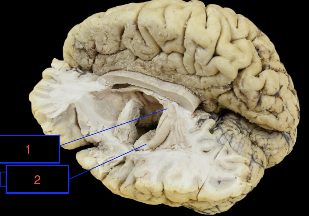 <p>1</p>
