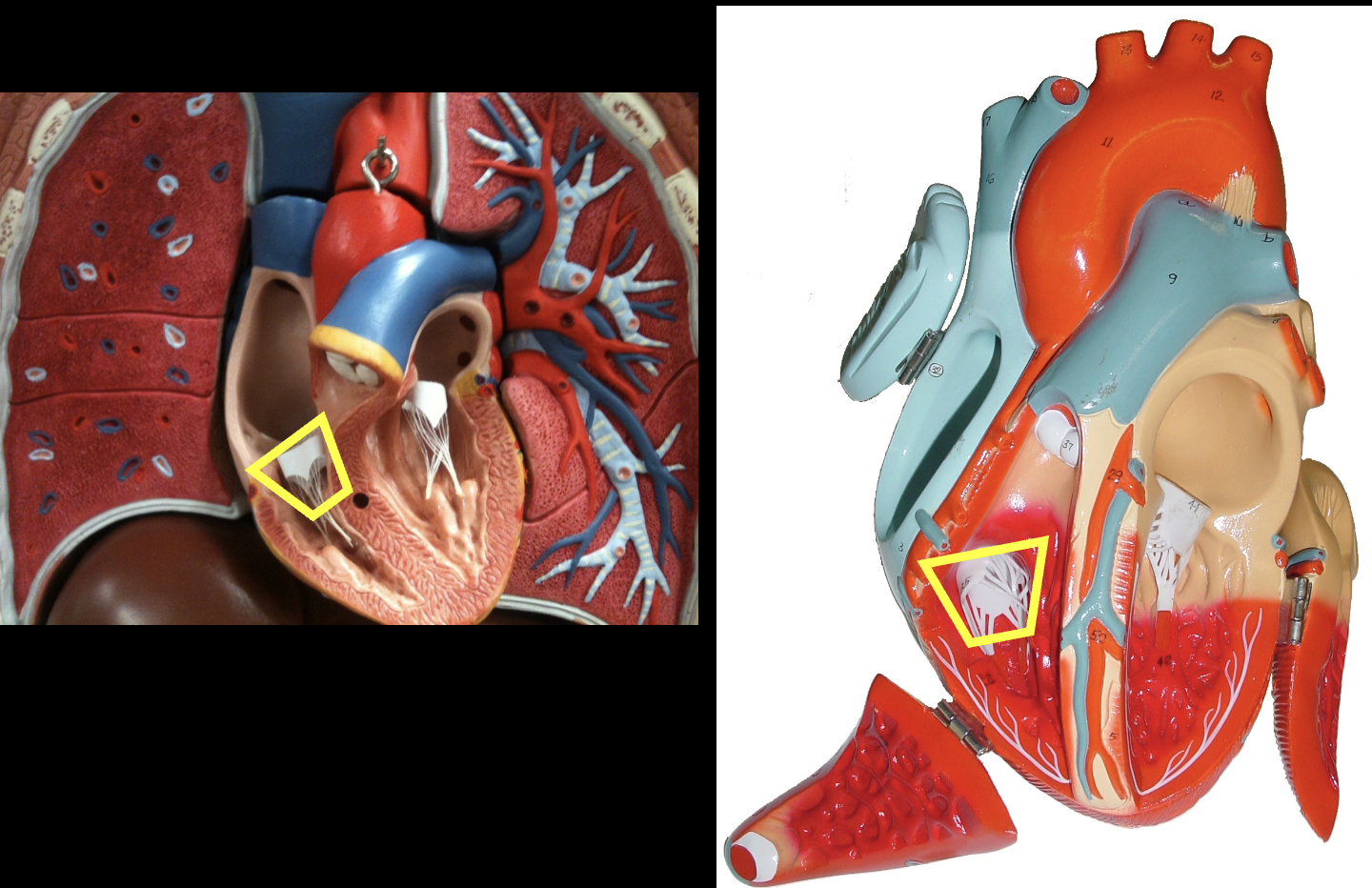 <p>what part of the heart muscle is shown?</p>