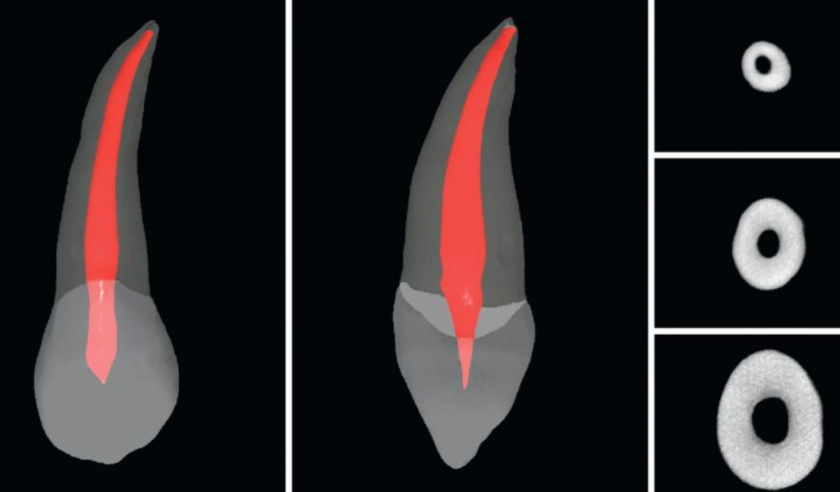 <p>What % of maxillary canines have 1 canal?</p>