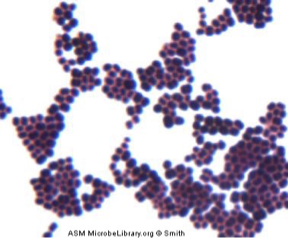 <p>Classification of bacteria that stain purple and have a cell wall containing peptidoglycan and techoic acid cross-links.</p>