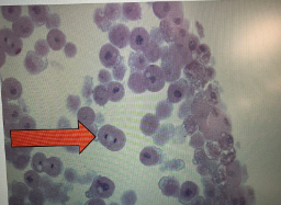 <p>What stage of mitosis is this</p>
