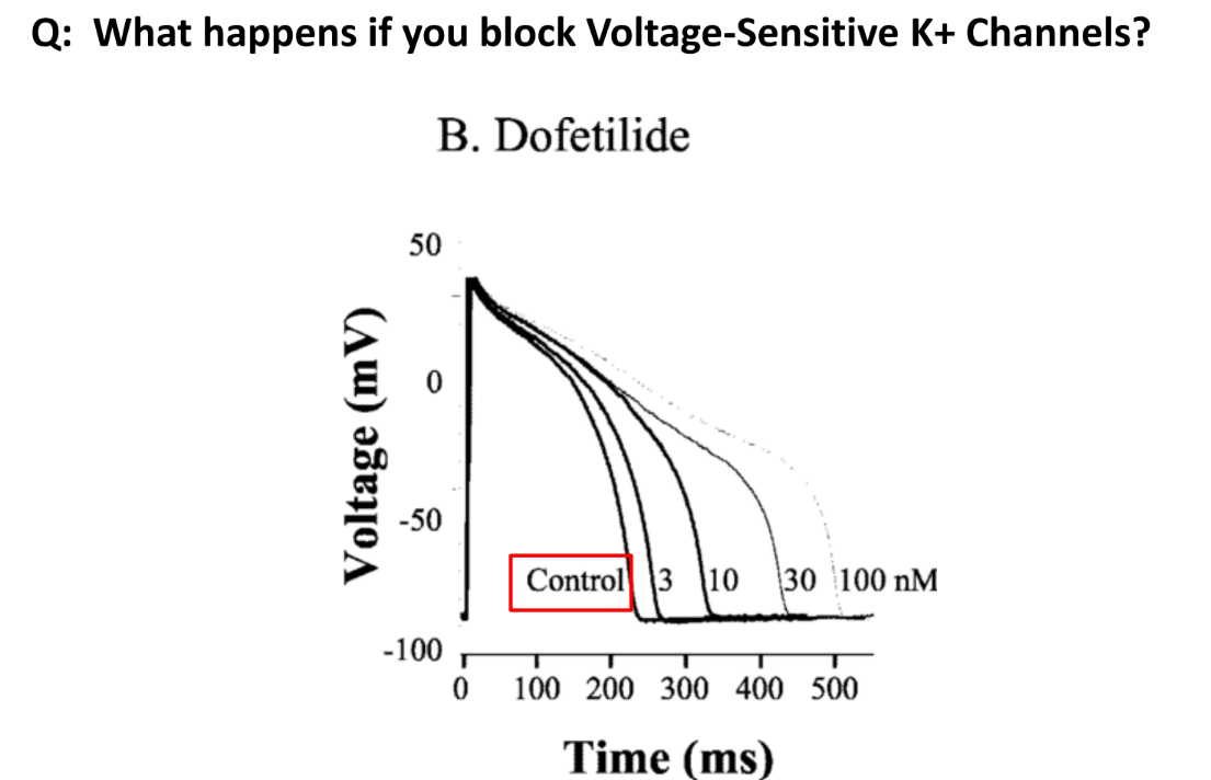 <p>AP is prolonged</p>