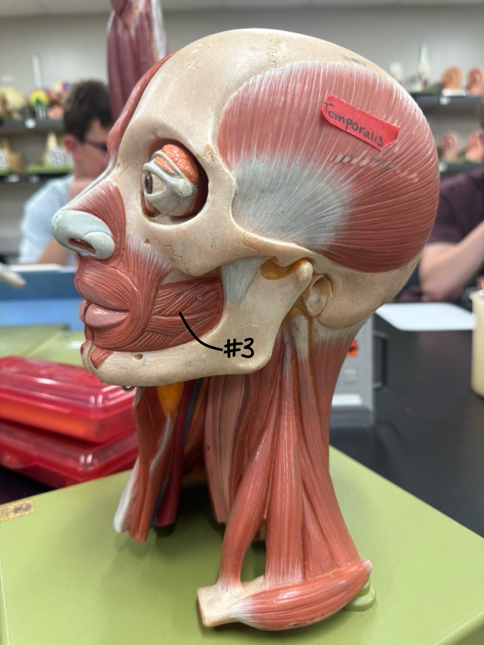 <p>What muscle is labeled at #3?</p>