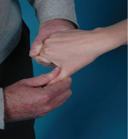 <ul><li><p><span>PURPOSE- Identify degenerative joint disease in the metacarpophalangeal or metacarpotrapezial joint</span></p></li><li><p><span>DESCRIPTION- The examiner holds the patient’s hand with one hand and grasps the patient’s thumb below the metacarpophalangeal joint with the other hand. The examiner then applies axial compression and rotation to the metacarpophalangeal joint</span></p></li><li><p><span>RESULT- If pain is elicited, the test is positive and indicative of degenerative joint disease in the metacarpophalangeal or metacarpotrapezial joint</span></p></li></ul><p></p>