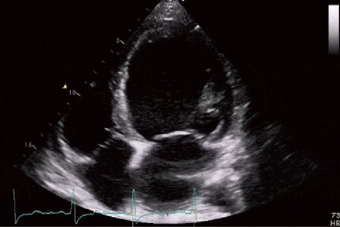<p>Diagnose this pathology</p>