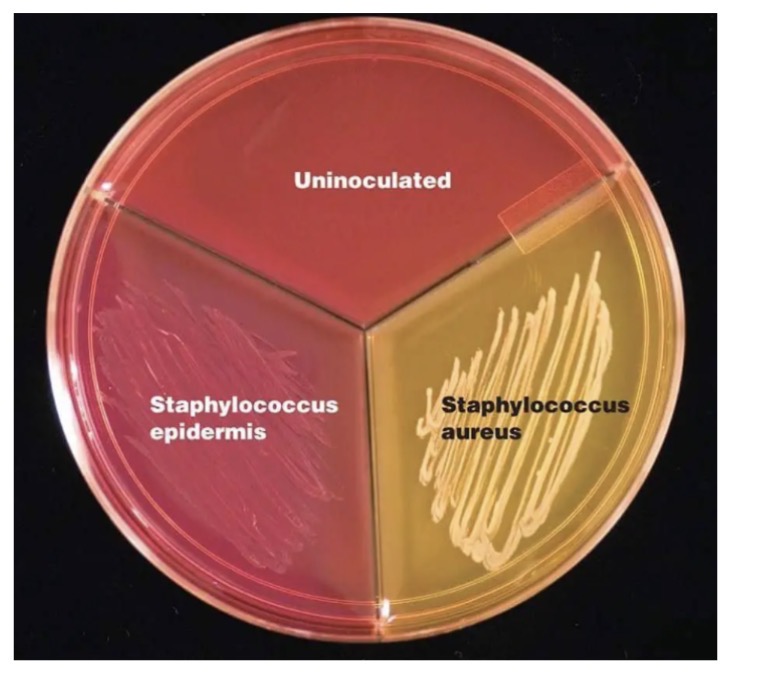 <p>MSA (Mannitol Salt Agar)</p>