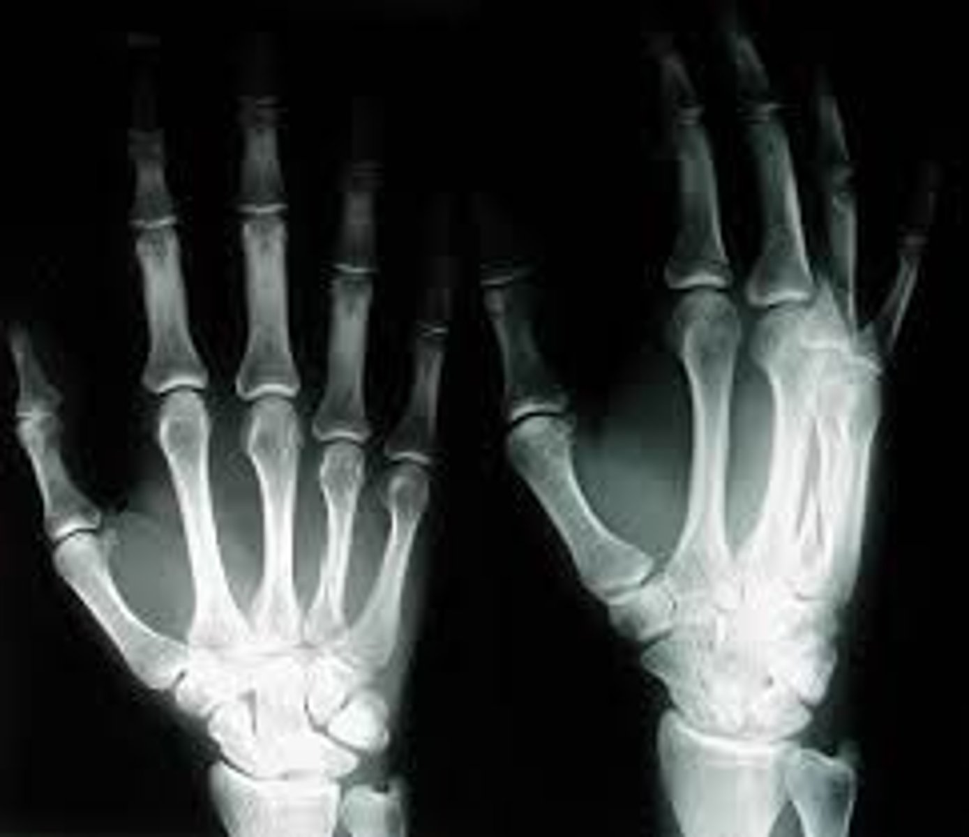 <p>Uses X-rays to view dense structures.</p>