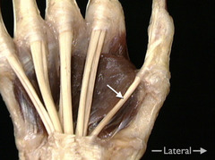 <p>In this anterior view of the right hand, identify the muscle whose tendon is indicated by the arrow.</p>