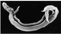 <p>Caused by primarily 3 separate species of the trematode Schistosoma (S. mansoni, S. japonicum (Intestinal) and S. haemotobium (bladder)</p><p>.</p><p>Overview</p><p>- Adult worms live in the mesenteric (intestinal) or vesicular (bladder)</p><p>- Pathology is caused by the presence of eggs in the gut and bladder tissue and in organs around the body.</p><p>- around 250 million infected and 200,000 die each year, endemic in ~70 countries.</p><p>- Disease is contracted by bathing or washing in water contaminated with the motile form of the parasite that burrow into the skin.</p><p>- Malnutrition especially in children</p><p>- Adults live for around 20 years in human host</p><p>.</p><p>- this is what we call a vector-borne parasite, but the vector is a snail (snail is the host before you in the lifecycle)</p><p>- way you contract is if ur in South America you go for a swim in the water, and when in the water, bare legged, parasites are swimming around and burrow through skin</p><p>- parasites lose little tail once they burrow the skin and make thier way around body via lungs and eventuially end up in the blood system and then they head to your gut</p><p>- when they get to your gut, they meet the opposite sex, and males and females get together and migate to vessels around gut or vessels around your bladder</p><p>- once they do that they pair up for life, and coat themselves with your antigen</p><p>- female lays eggs, and as the eggs try to go into gut so they get washed up in the liver and cause severe immune reaction</p><p>- can also cause severe immune reaction in the gut</p>