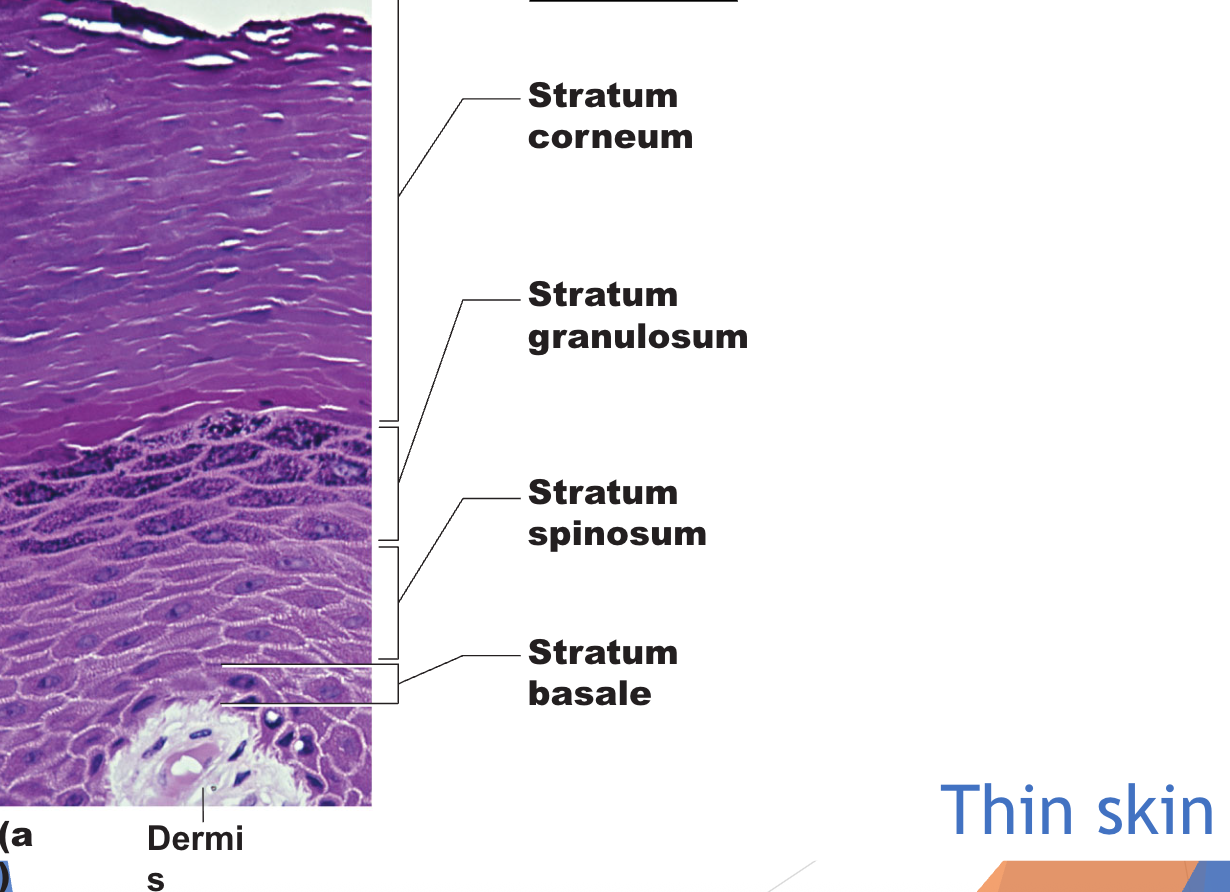 <p>Four layers (strata) are present all over body - hairy skin</p><p>Stratified squamous keratinizing epithelium</p>