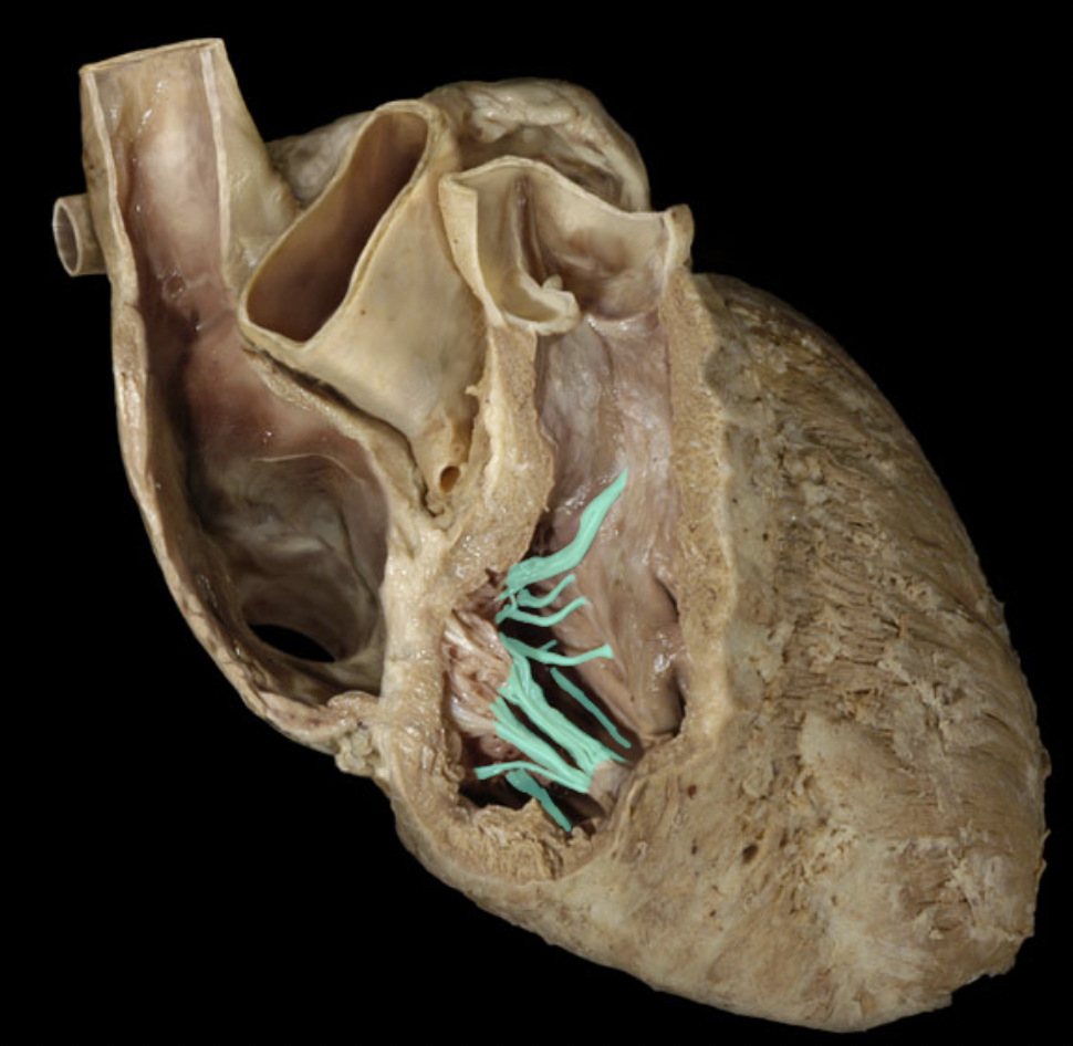 <p>Identify the feature of the right ventricle</p>