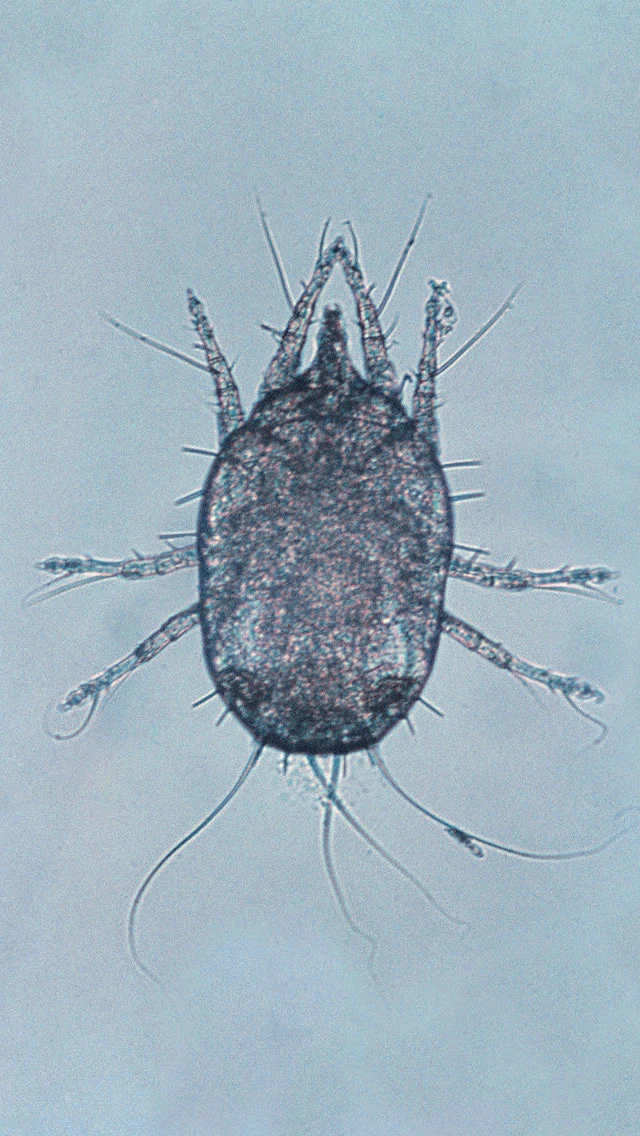 <p><strong>1 of the 3 Main Categories of Parasites:</strong></p><ul><li><p>Subcategories include:</p><ul><li><p>Insects</p></li><li><p>Ticks</p></li><li><p>Mites</p></li></ul></li></ul><p></p>