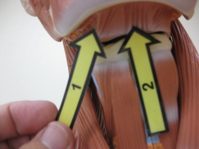 <p>What is at #1?</p>