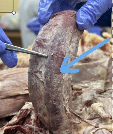 <p><span>keeps the urethra open for urination and ejaculation</span></p>