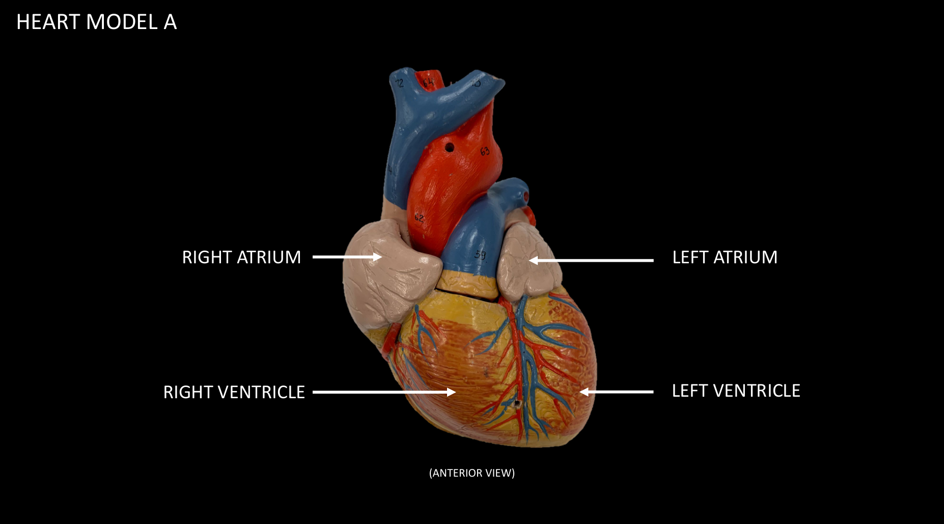<p>LEFT ATRIUM</p>
