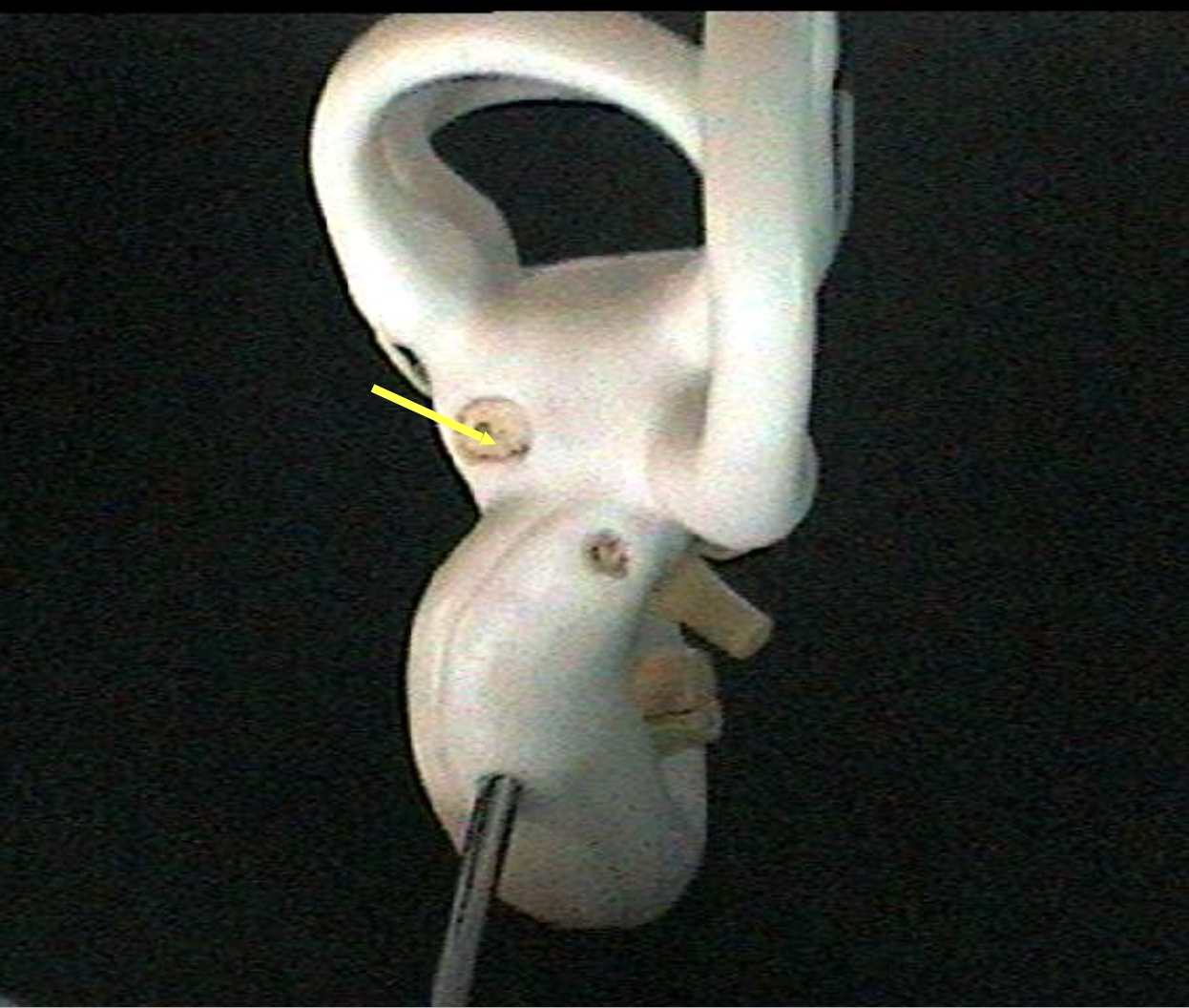 <p>Identify the inner ear parts.</p>