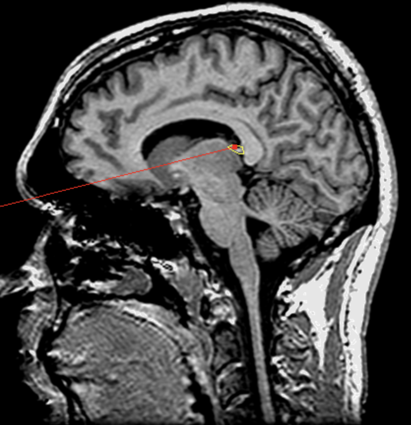 <p>What is the area highlighted called?</p>
