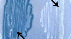 <p>Which result is positive and which one is a negative lipid hydrolysis test?</p>