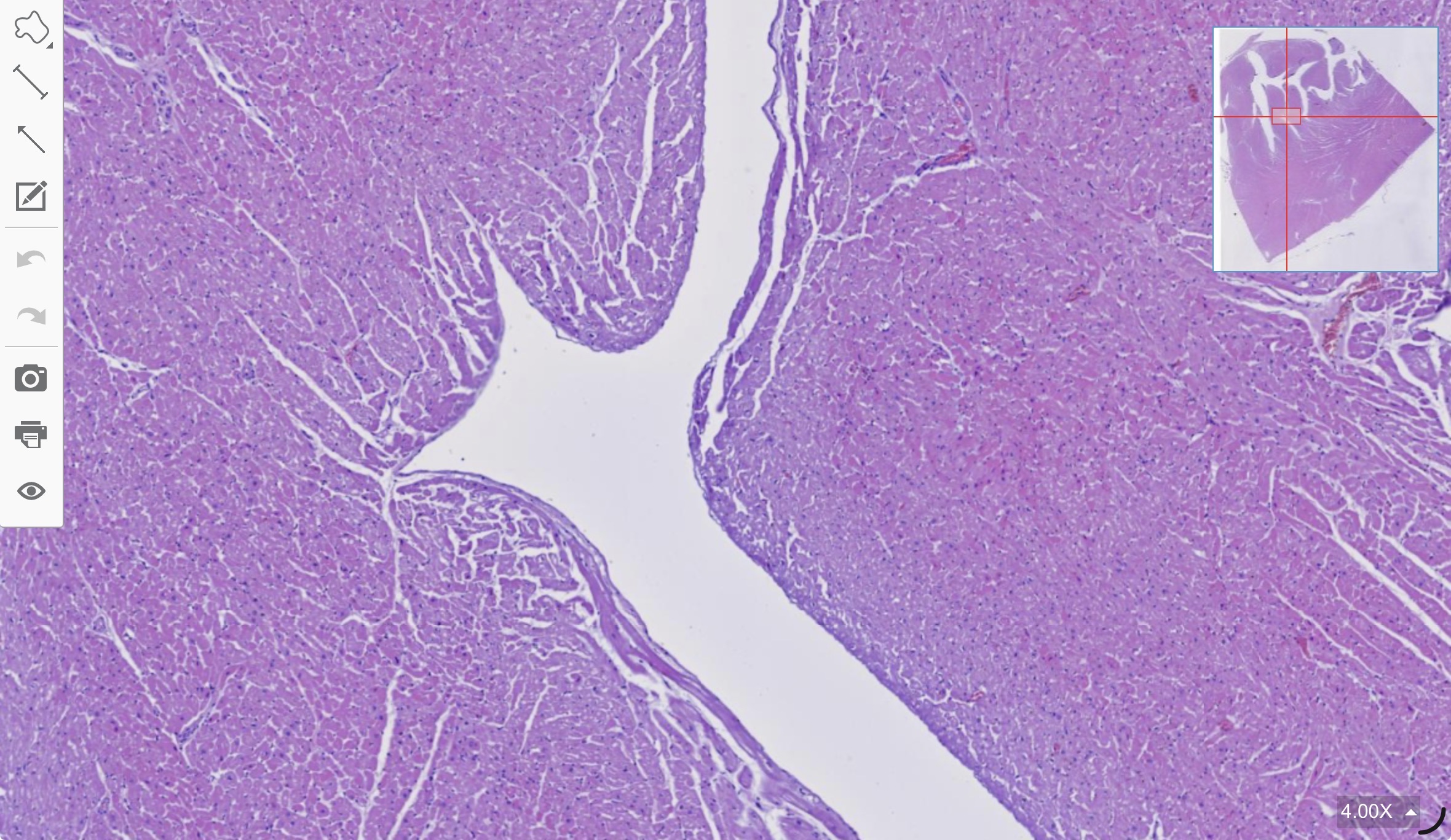 term image
