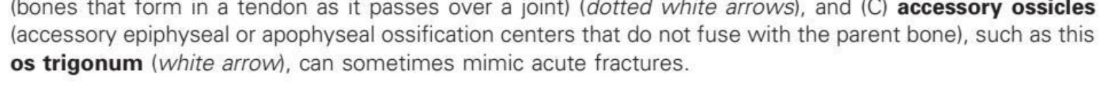 <p>accessory ossicles that can mimic acute fractures</p>