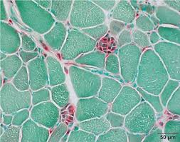 <p>acid phosphatase results:</p><p>red:</p><p>green:</p>