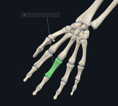 <p>Name the bone highlighted green and marked by the X</p>