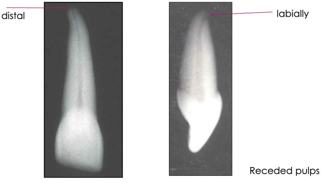 <p>distal; labially </p>